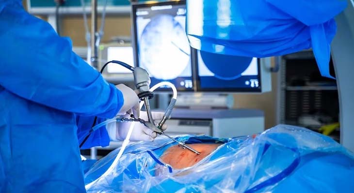 Endoscopic Spine Surgeries