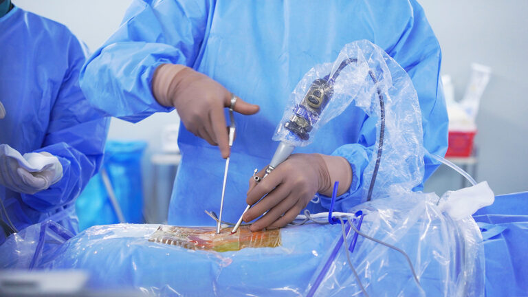 Endoscopic Spine Surgeries
